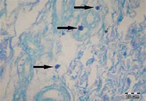 Analysis Of Toluidine Blue Stained Sections Mast Cell Staining In