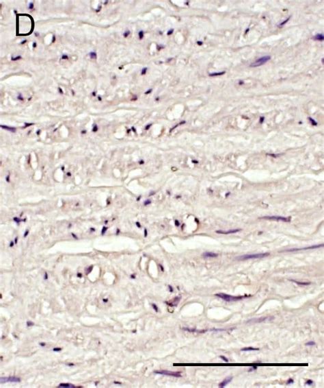 ADAMTS1 Antibody AF5867 Novus Biologicals