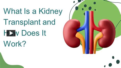 Ppt What Is A Kidney Transplant And How Does It Work Powerpoint