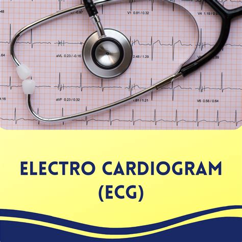 Electro Cardiogram Ecg Impact Diagnostics