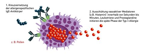 Typ I Allergien