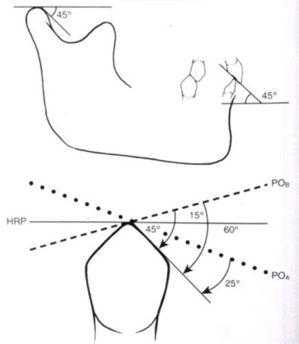 Determinants Of Occlusal Morphology Flashcards Quizlet