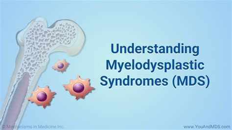 Understanding Myelodysplastic Syndromes With Images Syndrome