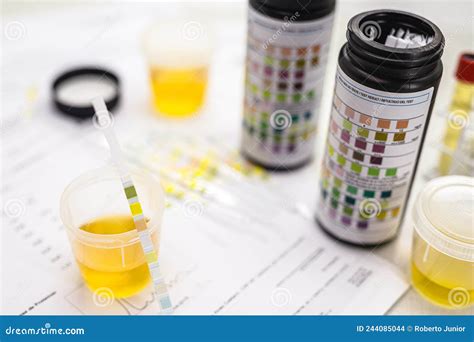 Reagent Strip For Urinalysis Routine Urinalysis Urine Test Analysis