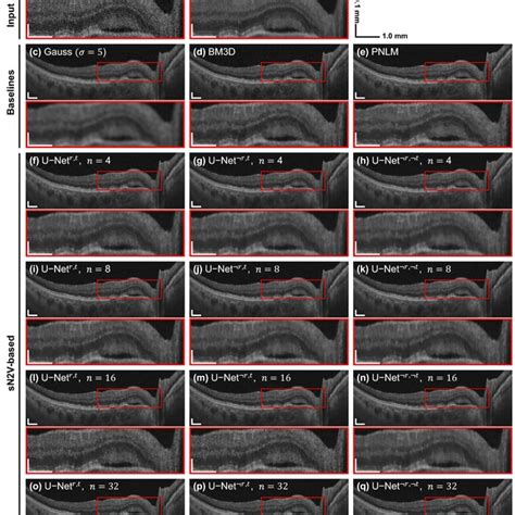 Example For 2D Denoising Of A B Scan From The Evaluation Dataset Based