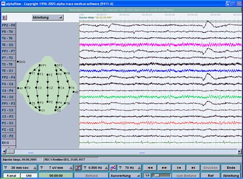 Eeg — The Sonenvir Project Portal