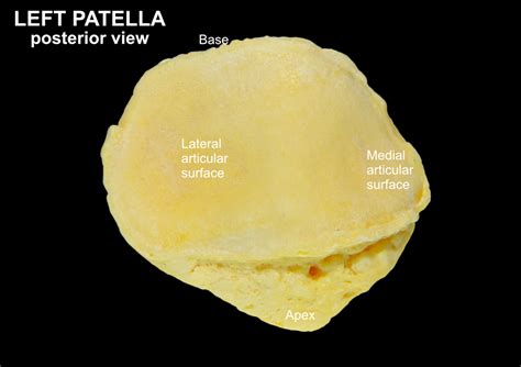 PATELLA – Clinical Anatomy