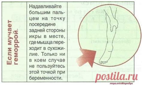 Если мучает геморрой | БОЛЯЧКИ: ГЕМОРРОЙ, ПРЯМАЯ КИШКА | Постила