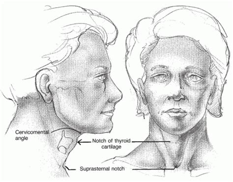 The Aging Neck Ento Key