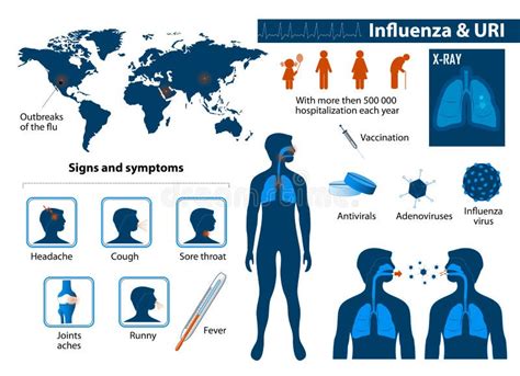 Influenza & Upper Respiratory Tract Infections Stock Vector - Image ...