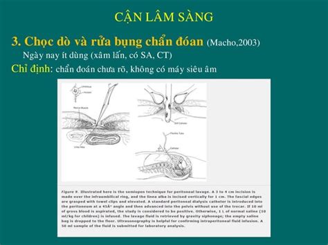 Chấn thương và vết thương bụng 2019 Đại học Y dược TPHCM PPT