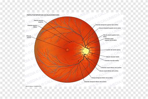 Dilated Fundus Examination Eye Glaucoma Esame Del Fondo Oculare Eye