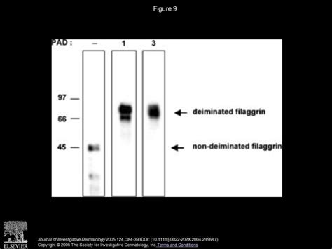 Peptidylarginine Deiminase Isoforms Are Expressed In The Epidermis