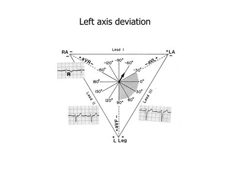 Ppt Electrophysiologic Backround For Ecg Evaluation Powerpoint