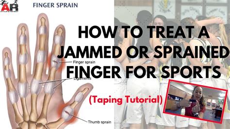 How To Treat a Jammed or Sprained Finger For Sports - YouTube