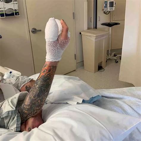 Ozzy Osbourne Recovers In Hospital With Ice Cream After Hand Surgery