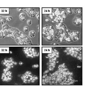 TGF 1 Induces Apoptosis In FaO Cells FaO Cells Were Treated With TGF 1