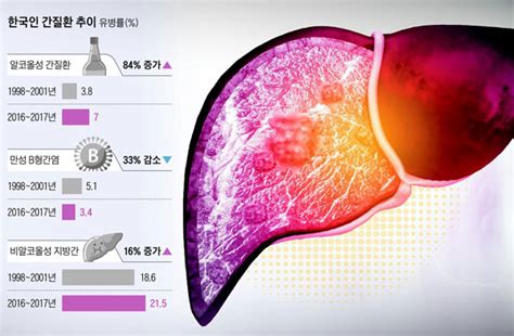 20·30대 술 의존 늘었나… 알코올 간질환 급증 당신의 건강가이드 헬스조선