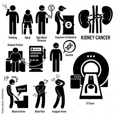 Kidney Cancer Symptoms Causes Risk Factors Diagnosis Stick Figure ...