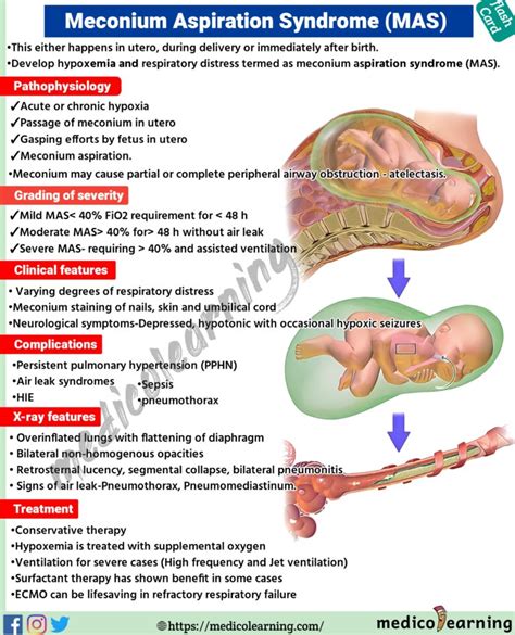 Vernal Keratoconjunctivitis Vkc Spring Catarrh Medicolearning