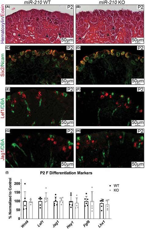 Deletion Of Hypoxia‐responsive Microrna‐210 Results In A Sex‐specific