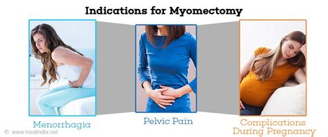 Myomectomy - Indications, Types, Preparation, Procedure & Complications