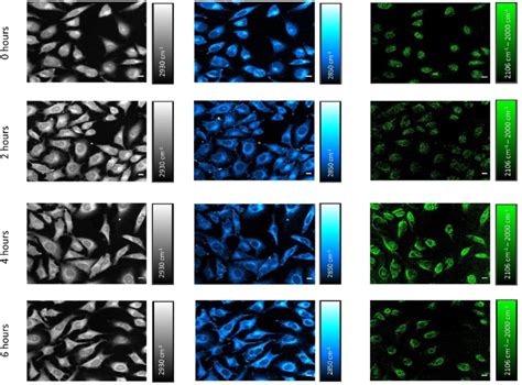 Figure S14 Representative SRS Images Of Live HeLa Cells After The