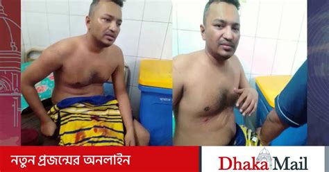 ছাত্রদলের সাবেক সভাপতি শ্রাবণের ওপর ছাত্রলীগের হামলা