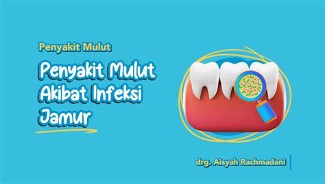 Penyakit Mulut Akibat Infeksi Jamur