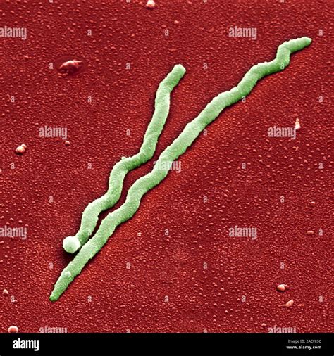 Lyme disease bacteria. Coloured scanning electron micrograph (SEM) of ...