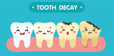 Top Causes Of Tooth Decay, Symptoms and Treatment