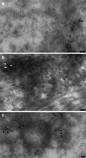 Ultrastructural Localization Of Ecm In The Human Skin Basement