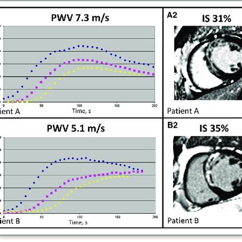 Case examples. Representative example of 2 male patients with anterior... | Download Scientific ...