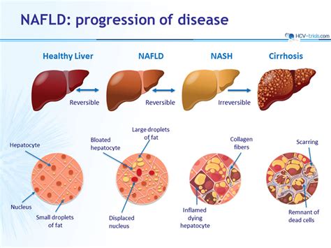 HCV-Trials.com : A regularly updated website with all most recent clinical trials data in HCV ...