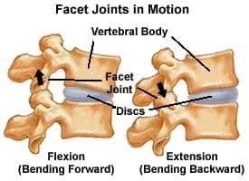 Bad Mattress or Bad Back? Facet Arthritis Symptoms | Florida Joint and ...