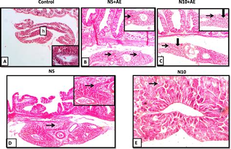 Representative Photomicrograph Of Nile Tilapia Liver Section Following