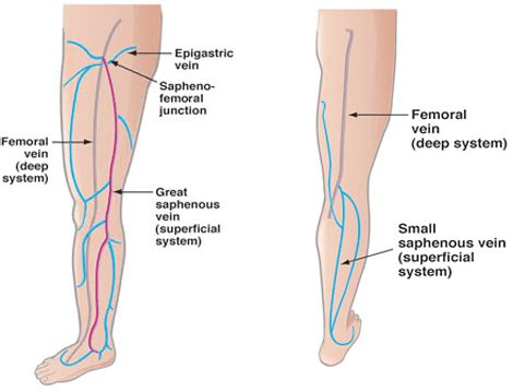 Venous Disease Warner Robins Ga Middle Georgia Vascular Surgery