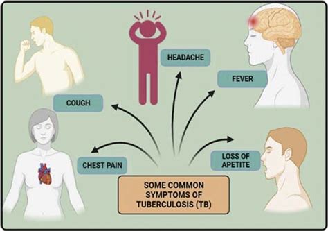 4 Diagrammatic Illustration Of Some Of The Common Symptoms Of