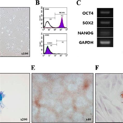 Characterisation Of BBM MSCs A Morphology Of BBM MSCs Observed By