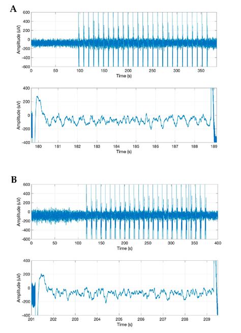 Frontal Electrocorticogram Ecog Features During Stimulation Of The