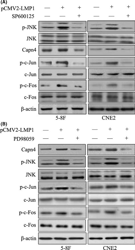 Erkjnk Is Involved In Epstein‐barr Virus Latent Membrane Protein 1