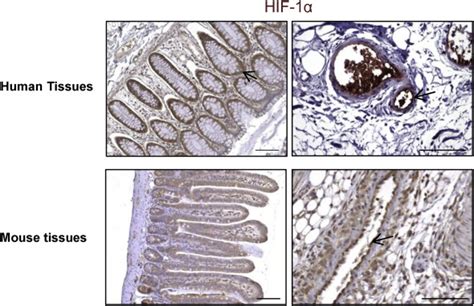 HIF 1α Deletion in the Endothelium but Not in the Epithelium Protects