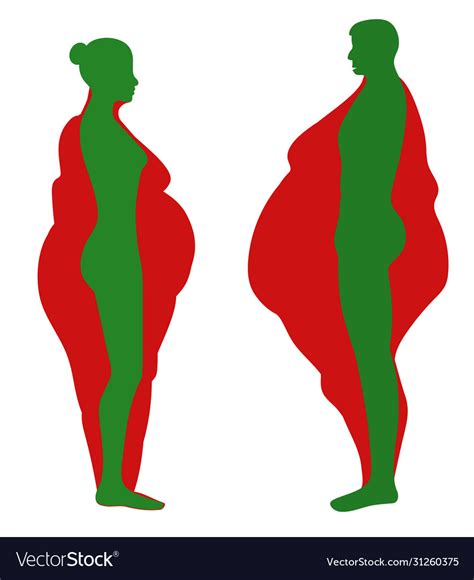 Obesity Royalty Free Vector Image Vectorstock