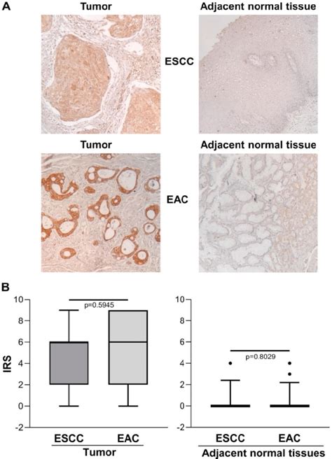 A Representative Immunohistochemical Analysis Of Eno1 Protein