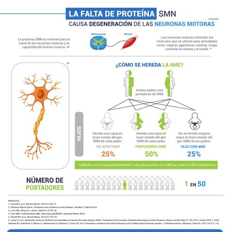 Qué causa la atrofia muscular espinal Ame