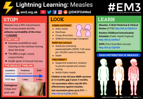 Measles Treatment For Adults