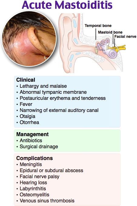 Acute Mastoiditis Pediatric Nurse Practitioner Medical Surgical
