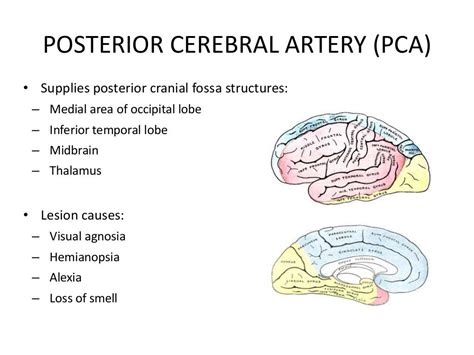 Posterior circulation stroke Syndromes