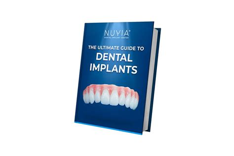 Full Mouth Dental Implants Unlock The Secrets With The Ultimate Guide