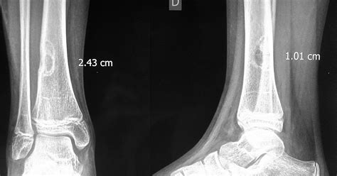 Residencia Radiología